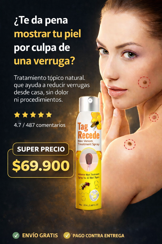 TAG RECEDE👌La forma de quitar esa berrugas